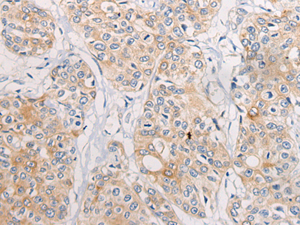 Rabbit Polyclonal Antibody to CPD