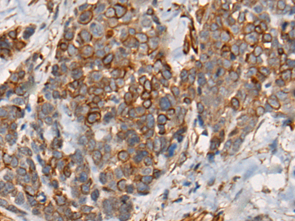 Rabbit Polyclonal Antibody to CARMIL1