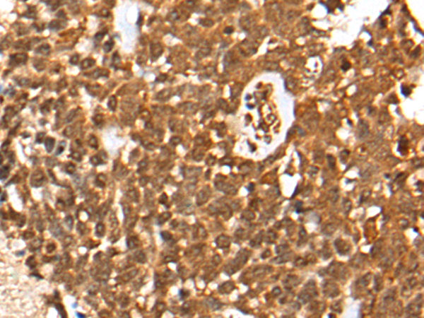 Rabbit Polyclonal Antibody to CASP8