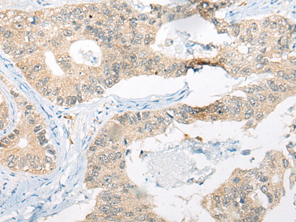 Rabbit Polyclonal Antibody to CTSF