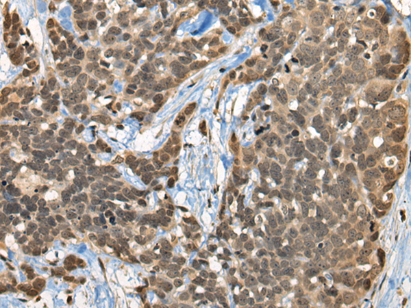Rabbit Polyclonal Antibody to CBFA2T3