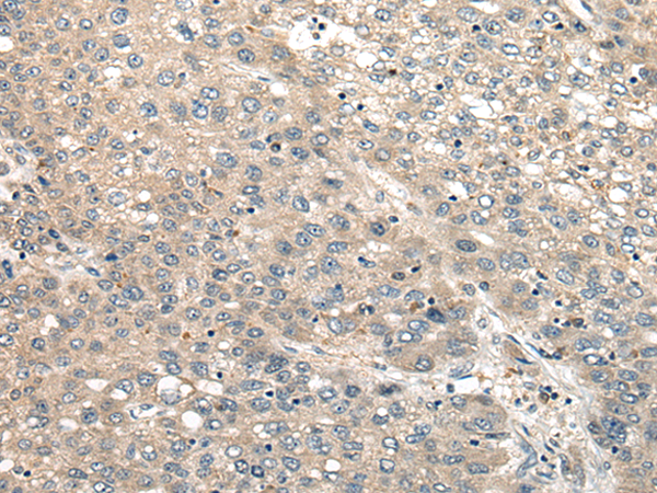 Rabbit Polyclonal Antibody to CBLN1