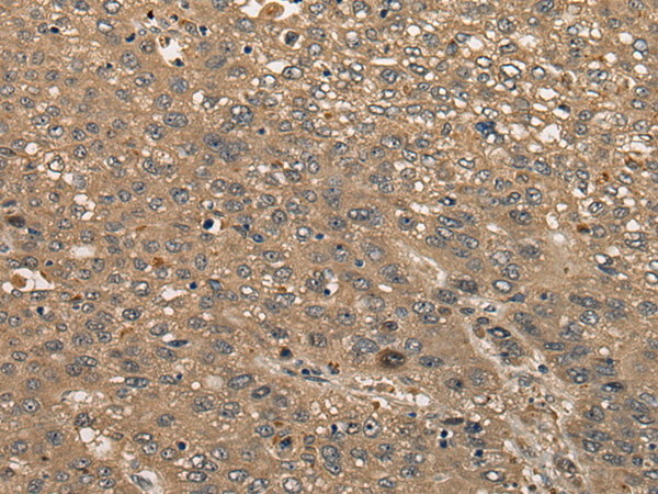 Rabbit Polyclonal Antibody to CBLN3