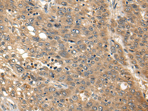 Rabbit Polyclonal Antibody to PTK7