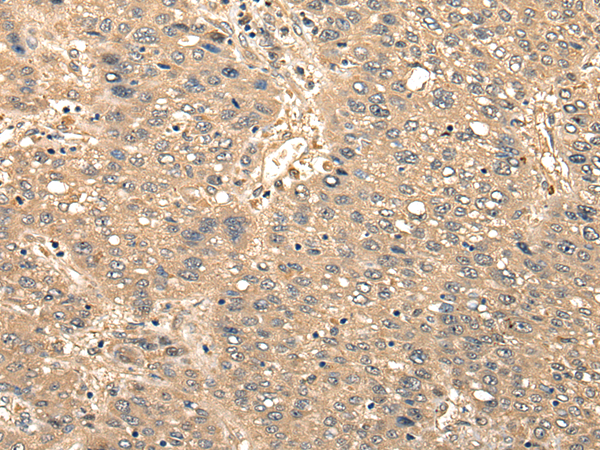 Rabbit Polyclonal Antibody to CCNYL1