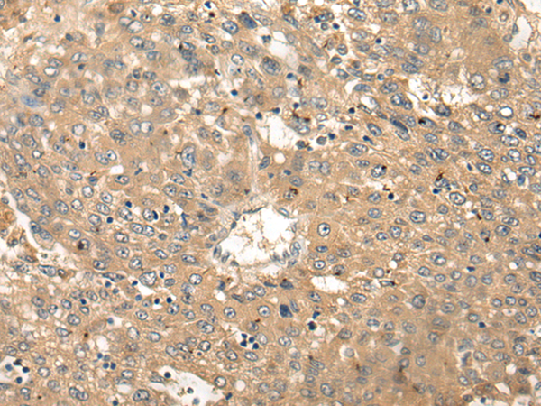 Rabbit Polyclonal Antibody to CDK20