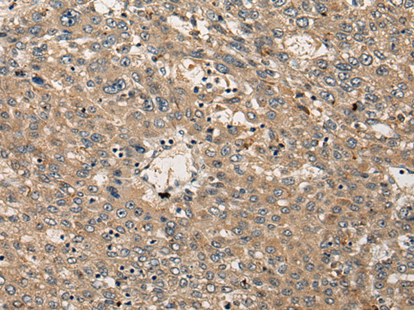 Rabbit Polyclonal Antibody to TNFSF8
