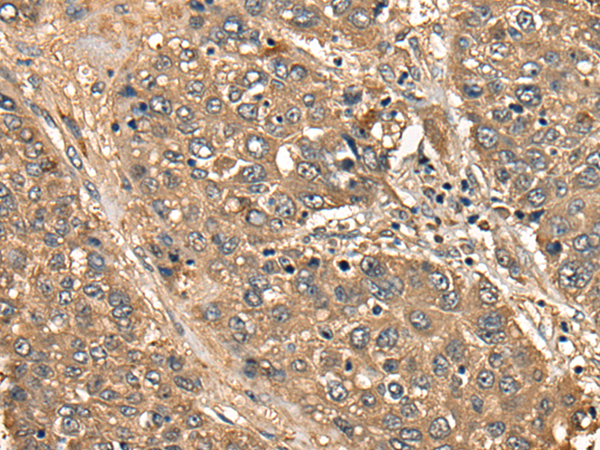 Rabbit Polyclonal Antibody to CD1B