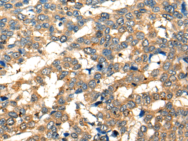 Rabbit Polyclonal Antibody to CD28