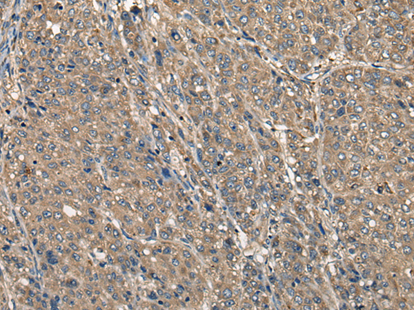 Rabbit Polyclonal Antibody to CD5