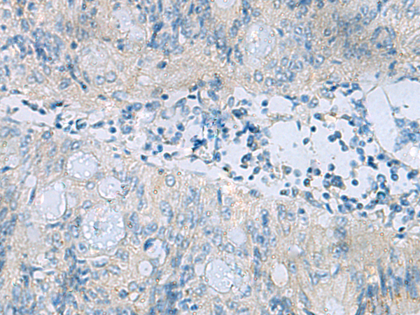 Rabbit Polyclonal Antibody to ITGAV