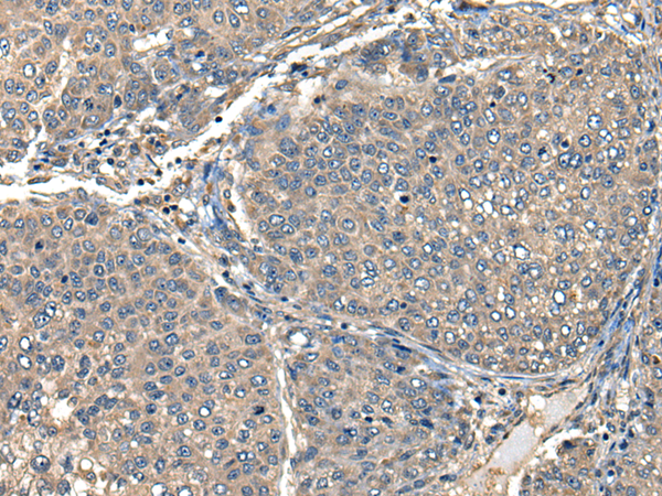 Rabbit Polyclonal Antibody to FCGR1A