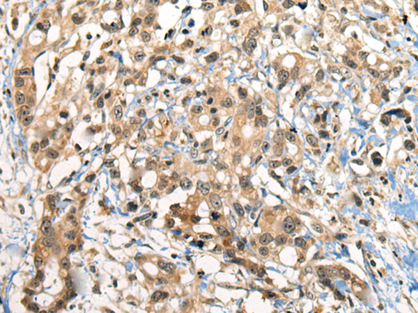 Rabbit Polyclonal Antibody to CDC14B