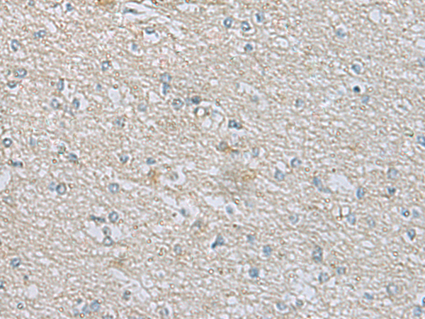 Rabbit Polyclonal Antibody to CDH12