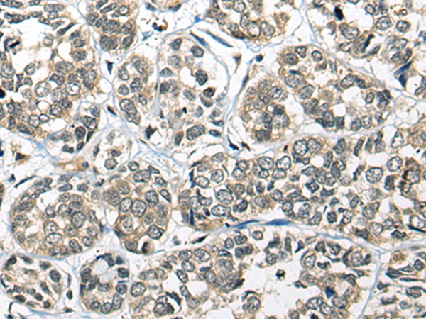 Rabbit Polyclonal Antibody to CDKL1