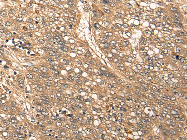 Rabbit Polyclonal Antibody to CDRT15L2