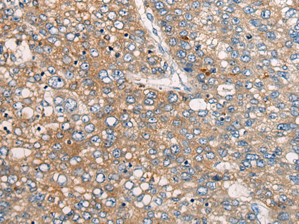 Rabbit Polyclonal Antibody to CDV3