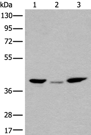 Rabbit Polyclonal Antibody to HDHD5