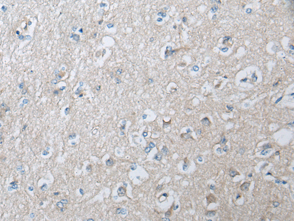 Rabbit Polyclonal Antibody to GULP1