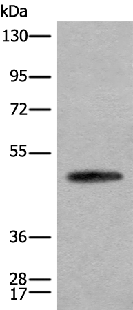 Rabbit Polyclonal Antibody to CADM2