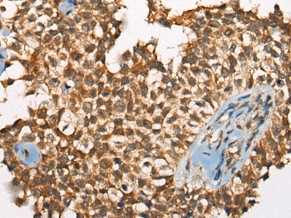 Rabbit Polyclonal Antibody to ODF2