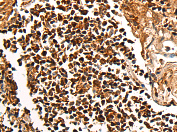 Rabbit Polyclonal Antibody to CENPT