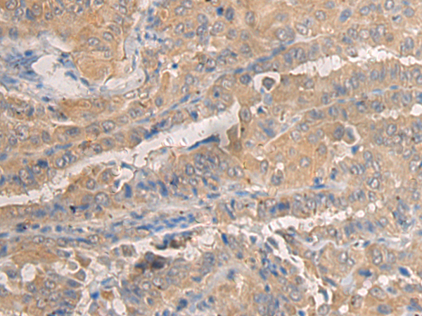 Rabbit Polyclonal Antibody to AGAP3
