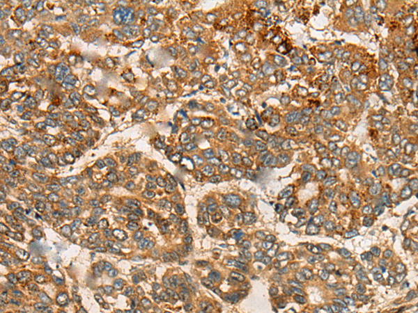 Rabbit Polyclonal Antibody to CNTLN
