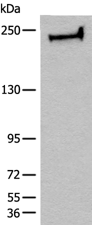 Rabbit Polyclonal Antibody to CEP170