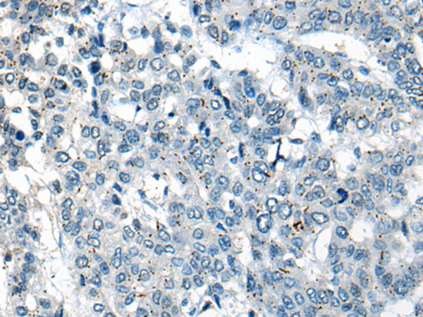 Rabbit Polyclonal Antibody to CEP89