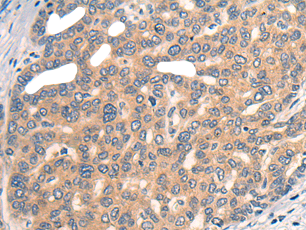 Rabbit Polyclonal Antibody to CP