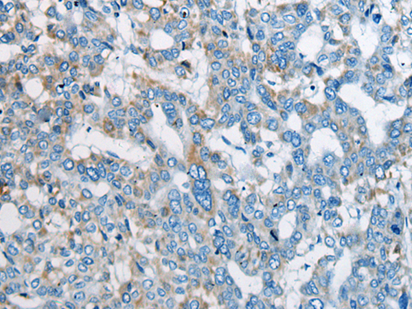 Rabbit Polyclonal Antibody to OTUD7B