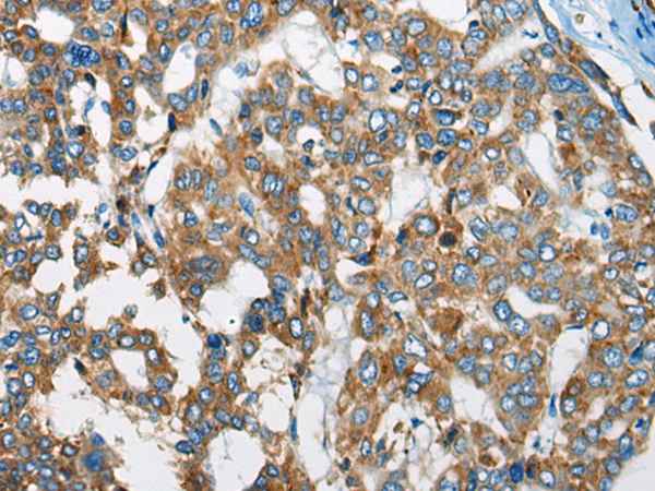 Rabbit Polyclonal Antibody to ZC2HC1A
