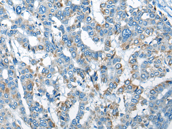 Rabbit Polyclonal Antibody to CHADL