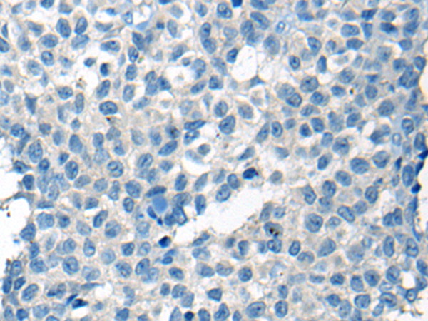 Rabbit Polyclonal Antibody to CHODL