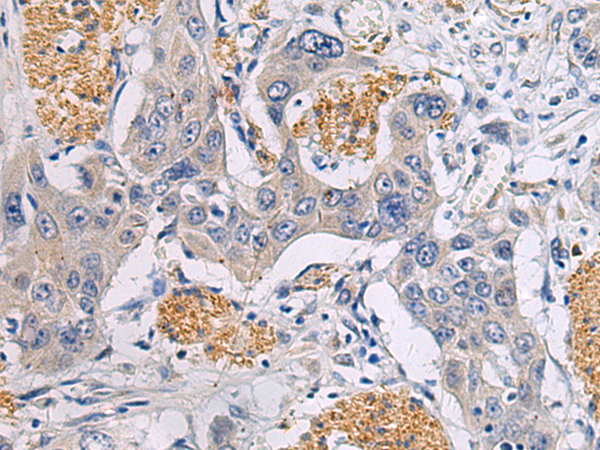 Rabbit Polyclonal Antibody to CHST3
