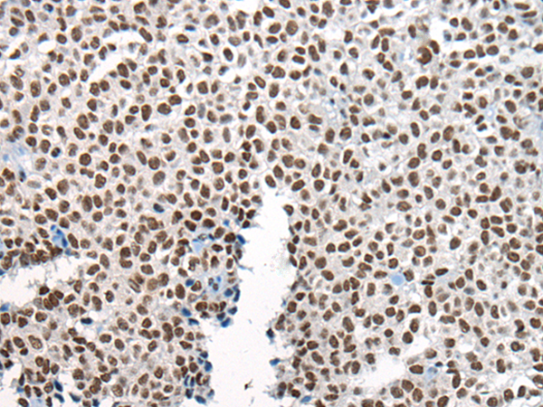 Rabbit Polyclonal Antibody to CHURC1