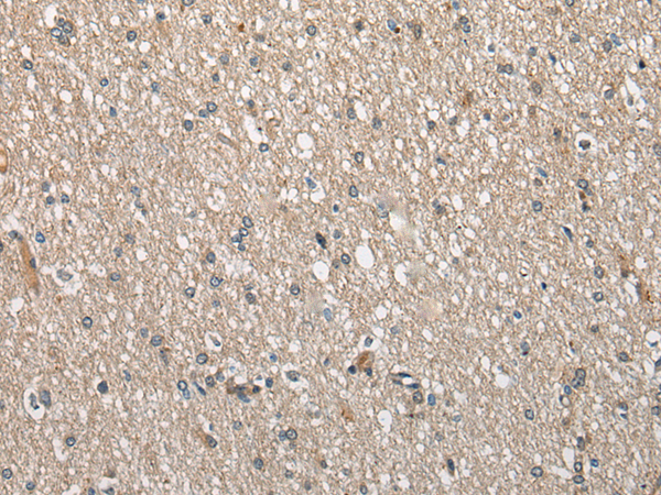 Rabbit Polyclonal Antibody to CIITA