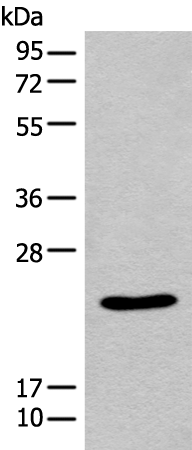 Rabbit Polyclonal Antibody to SARNP