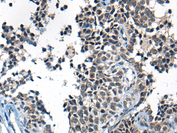 Rabbit Polyclonal Antibody to CITED2