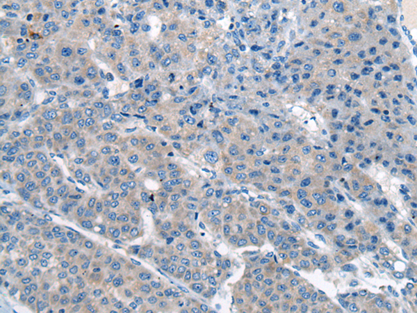 Rabbit Polyclonal Antibody to CITED4