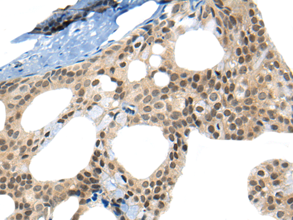 Rabbit Polyclonal Antibody to CKS2