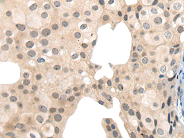 Rabbit Polyclonal Antibody to CKS1B