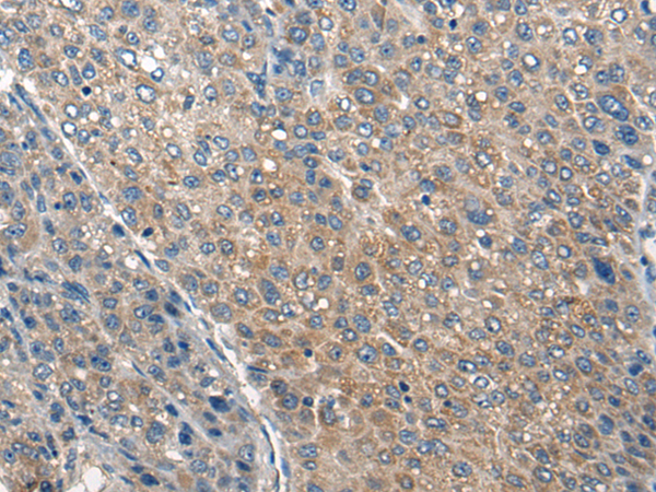 Rabbit Polyclonal Antibody to COL25A1