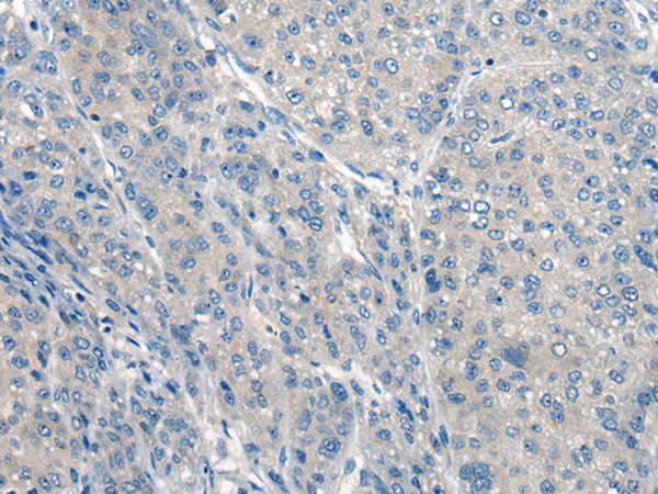 Rabbit Polyclonal Antibody to CLCNKA