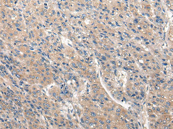 Rabbit Polyclonal Antibody to CLIC6