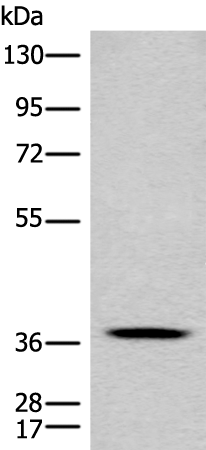 Rabbit Polyclonal Antibody to CLN5