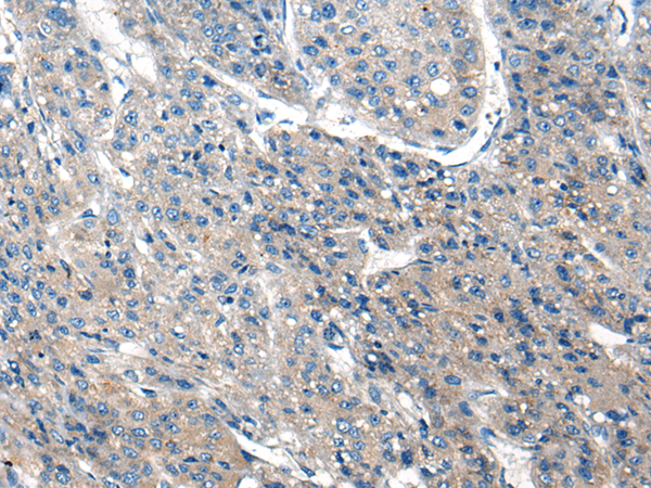 Rabbit Polyclonal Antibody to CLPX