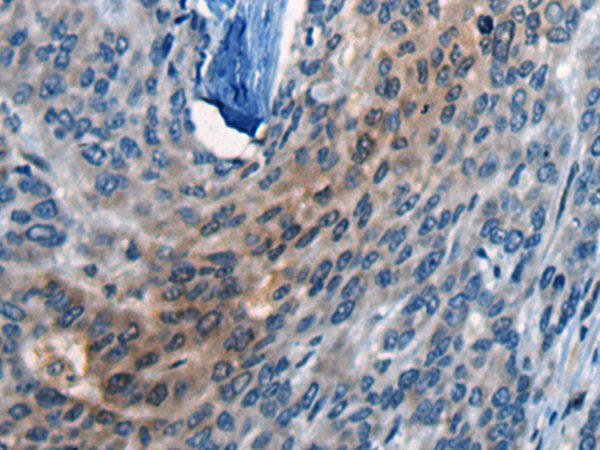 Rabbit Polyclonal Antibody to CLSTN1