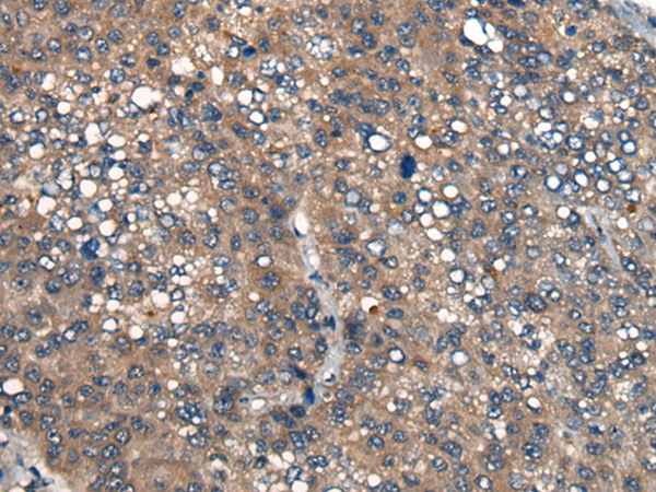 Rabbit Polyclonal Antibody to ICMT